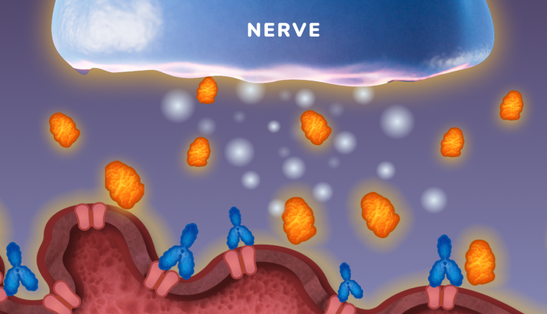 An illustration of the complement system attacking the neuromuscular junction